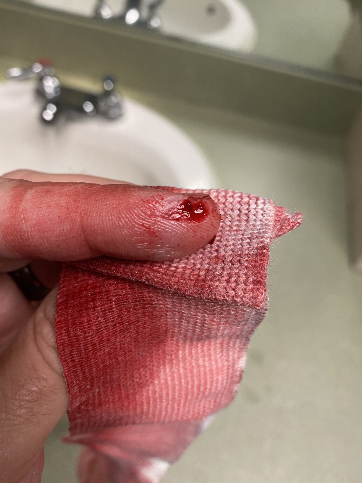 Cut finger from rotary cutter